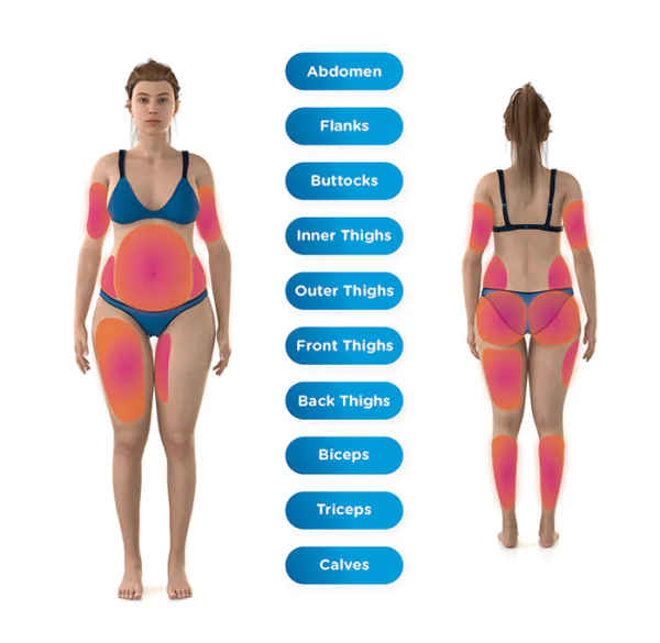 10 Body Areas EMSCUPLT NEO Can Treat